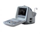 CHISON 9300 全数字化高档黑白便携式超声诊断系统